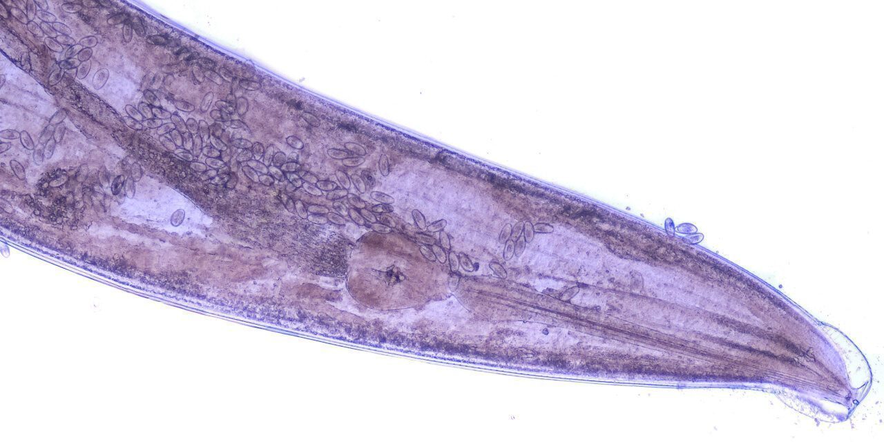 Fadenwürmer: Mikroskopische Aufnahme eines schwangeren Madenwurms
